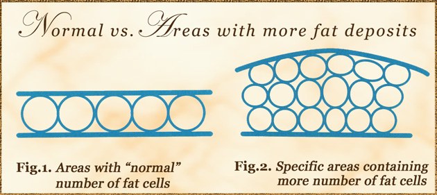 Mbode - FAJA BURNS can be a complication of lipo. Client: 2 weeks