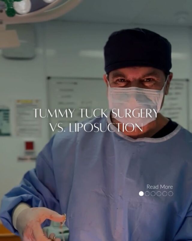 TUMMY TUCK VS LIPO @DrAllenRezai // When it comes to body contouring, it’s important to know which procedure best suits your goals. While both tummy tuck and liposuction offer transformative results, they target different areas and address specific concerns. Here’s a quick guide to help you decide which option might be right for you.

🔹 Tummy Tuck (Abdominoplasty): Ideal for removing excess skin and tightening abdominal muscles after pregnancy or weight loss. It’s a full transformation for a smoother, tighter abdomen. Tummy Tuck has a longer recovery period, usually around 2-4 weeks. You may need to wear a compression garment for support and avoid strenuous activities during the healing process.

🔹 Liposuction: Targets stubborn fat pockets that diet and exercise can’t budge. It’s perfect for contouring areas like the thighs, arms, and flanks. Recovery is quicker than a tummy tuck, usually 1-2 weeks. You may experience some swelling and bruising, but most people can return to light activities after a few days, with full recovery within a few weeks.

Choosing between a tummy tuck and liposuction depends on your individual goals, anatomy, and the extent of correction needed. Detailed consultation and correct technique are key in achieving the best possible outcome for You... #YOUMatter #NaturalLook

⚜️For Enquiries or to schedule a consultation Contact Your Preferred Clinic:

👉🏻 🇦🇪#Dubai @EliteClinicDubai
📞+971 (0)4431 2396

👉🏻 🇬🇧#London & #EastSussex @DrAllenRezai @SkinCision_Clinic
📞+44 (0)20 7580 8001
•
#DrAllenDubai #DrAllenRezai #EliteClinicDubai #TummyTuck #Liposuction #BodyContouring #MommyMakeover #PlasticSurgery #Abdominoplasty #MiniTuck #VASERLipo #Renuvion #JPlasma #SkinTightening #MusclePlication #LifeChangingJourney #Transformation #BodyGoals #HealthyLiving #DubaiLife #AbuDhabiLife