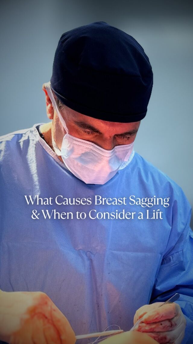 Breast ptosis (sagging) occurs naturally over time due to a combination of ageing, gravity, pregnancy, breastfeeding, and weight fluctuations. These factors can stretch the supporting ligaments and reduce skin elasticity, causing the breasts to lose their youthful position and firmness.

A breast lift (mastopexy) may be considered when:
– The nipple sits below the breast crease
– The areola has enlarged or changed position
– The breast lacks volume and shape

A lift repositions and reshapes the existing tissue, restoring contour without necessarily increasing size. Each treatment plan is personalised, based on your anatomy and goals. Schedule an appointment today.

☎️ +971 4 431 2396 | +971 52 892 8353
📩 info@elitecosmeticsurgery.ae
•
#EliteClinicDubai #DrAllenRezai #DrAllenDubai #BreastSurgery #BreastLiftDubai #UnderstandingPtosis #MastopexyFacts #BreastAesthetics #BreastReshaping #BreastReconstruction #BreastUplift #BreastAugmentation #BreastSculpting #LifeChangingJourney #UpliftedConfidence #DubaiWomen #NaturalLook #DubaiLife #AbuDhabiLife #Confidence #BodyPositivity #BestPlasticSurgeonDubai #DubaiWomen #MiddleEast