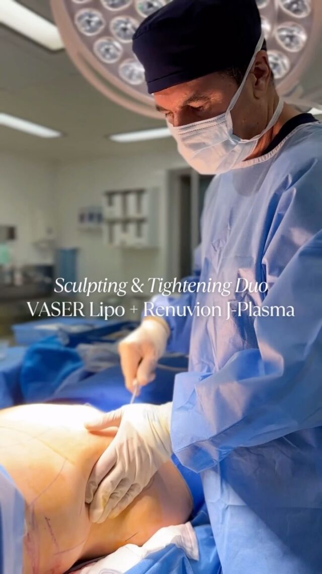 Sculpting & Tightening with VASERLipo and Renuvion: Why Combine These Two? When indicated, VASER Liposuction combined with RENUVION Skin Tightening is an excellent option for body sculpting, skin tightening and addressing the stubborn fatty deposits which cannot be improved with regular exercise and a balanced diet.

Together, this duo:
👉🏻 Enhances definition and contour
👉🏻Tightens lax skin without excisional surgery
👉🏻 Delivers more refined and long-lasting results
👉🏻 Requires only tiny incisions with minimal scarring

Detailed Consultation, Bespoke Treatment Plan and AfterCare, are key in achieving the Best possible Outcome for You. Schedule an initial thorough consultation with @DrAllenRezai and determine your suitability for this procedure.

☎️ +971 4 431 2396 | +971 52 892 8353
📩 info@elitecosmeticsurgery.ae
•
#EliteClinicDubai #DrAllenRezai #DrAllenDubai #VaserLipo #Renuvion #RenuvionJPlasma #Liposuction #Jplasmarenuvion #skintighteningtreatment #PlasticSurgery #vaserliposuction #bodycontouring #mummymakeover #liposuctiondubai #breastaugmentation #breastimplants #cosmeticsurgery #jplasmadubai #doublechin #mydubai #plasticsurgerybeforeandafter #looseskin #tightenskin #skintightening
