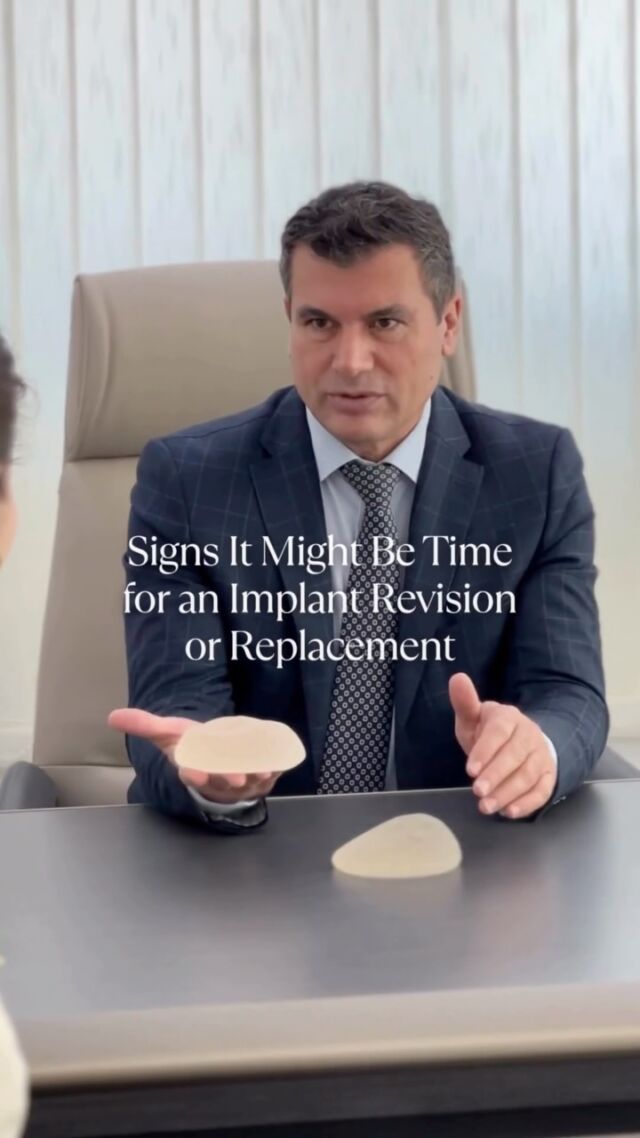 Breast implants are not lifetime devices. While routine replacement is not always necessary, certain signs may indicate it’s time to consider a revision:

– Significant changes in size, shape, or symmetry
– Hardening, discomfort, or capsular contracture
– Suspected implant rupture
– Visible wrinkling or rippling
– Desire to change implant type, position, or size

Implant revision is a personalised procedure that addresses both cosmetic goals and any medical concerns. A thorough Initial Consultation is key in achieving the Best Possible Outcome for You...

📸 For samples of Dr Allen's work, visit @DrAllenRezai 👈🏻

☎️ +971 4 431 2396 | +971 52 892 8353
📩 info@elitecosmeticsurgery.ae
•
#ImplantRevisionDubai #CapsularContracture #ChangeOfImplants #BreastImplantHealth #DrAllenRezai #DrAllenDubai #EliteClinicDubai #ImplantRevision #ImplantReplacement #BreastImplants #breastaugmentation #breastimplants #cosmeticsurgery #mydubai #dubailife #abudhabilife